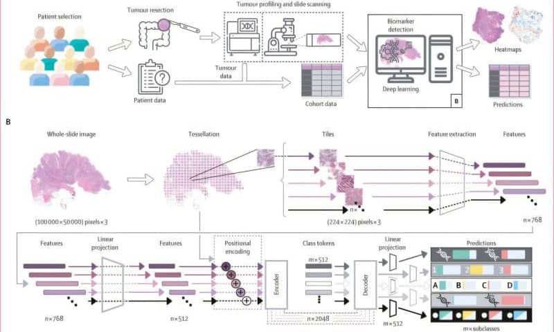 AI model simultaneously detects multiple genetic colorectal cancer markers in tissue samples