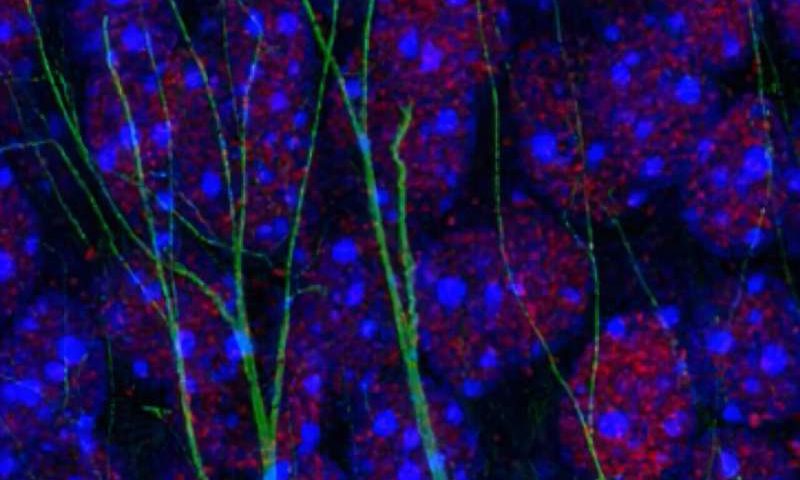 New insights into the epigenetic processes via which neuroinflammation causes memory loss