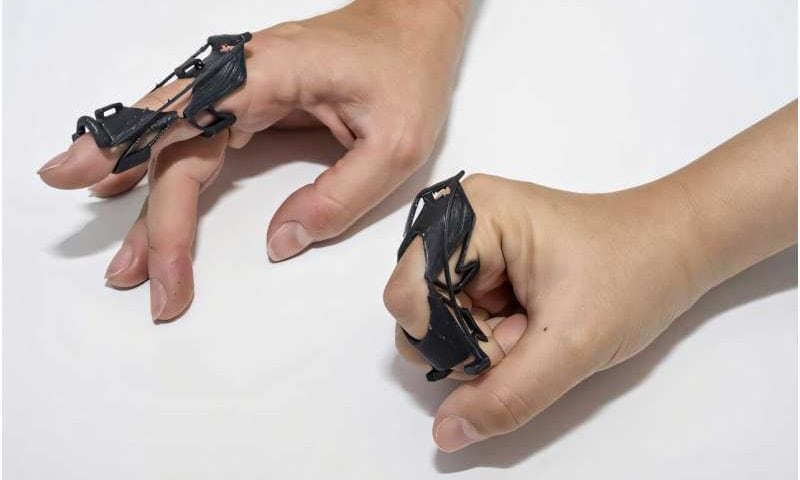 Customizable finger brace toggles between stiff and flexible for easier recovery