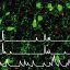 Eat, explore, rest: Leptin-sensing brain circuit helps overcome anxiety to meet vital needs
