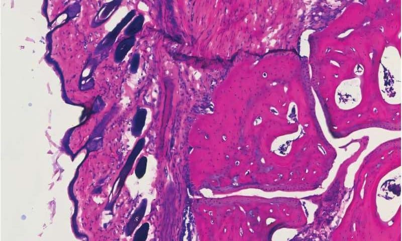 New lab-made antibody matches IVIG effectiveness at lower doses in mice