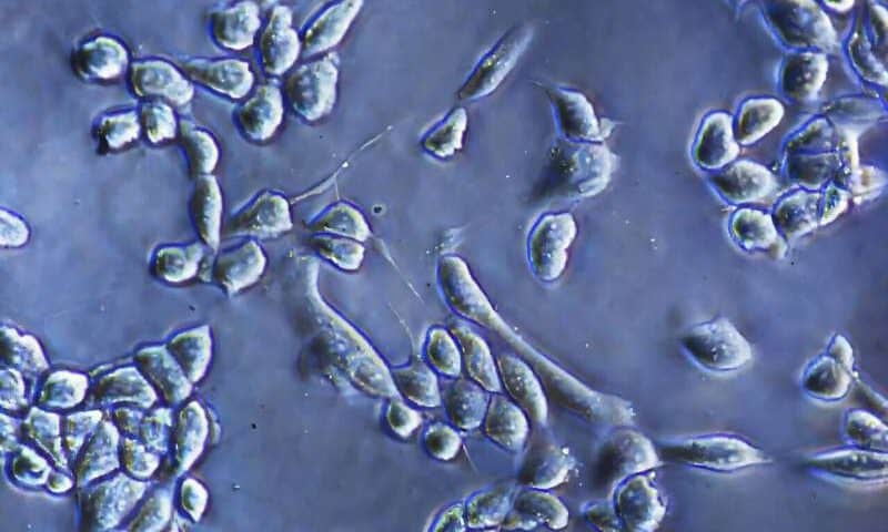 Enzyme-free approach gently detaches cells from culture surfaces