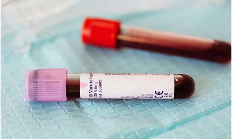 Disagreement between two kidney function tests predicts serious health problems