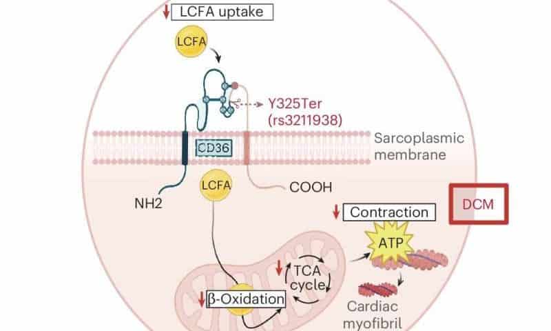 Common gene variant linked to higher heart disease risk in people with African ancestry