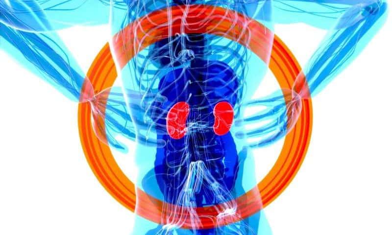 Chronic kidney disease is now the ninth leading cause of death, global analysis finds