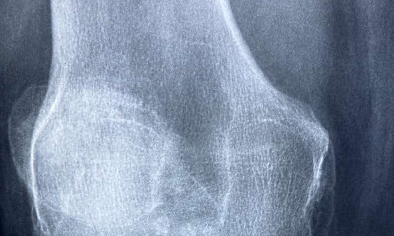 Inhibiting a master regulator of aging regenerates joint cartilage in mice