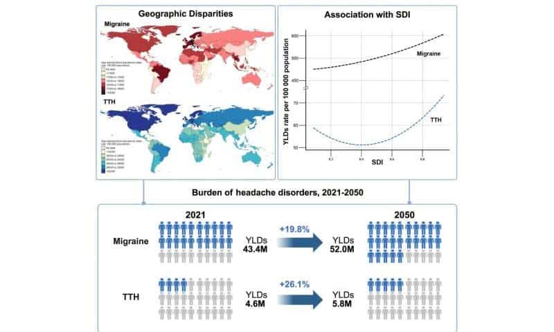 Migraines and headaches are a global burden that needs greater recognition, international study finds