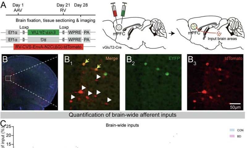 Gut bacteria may play role in bipolar depression by directly influencing brain connectivity