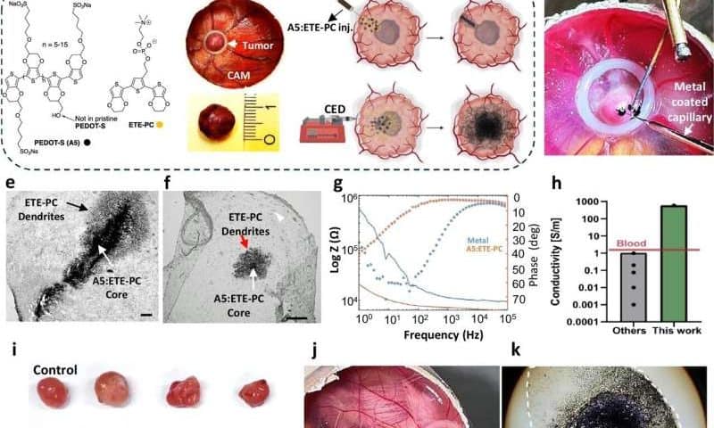 Electrotherapy using injectable nanoparticles offers hope for glioblastoma treatment