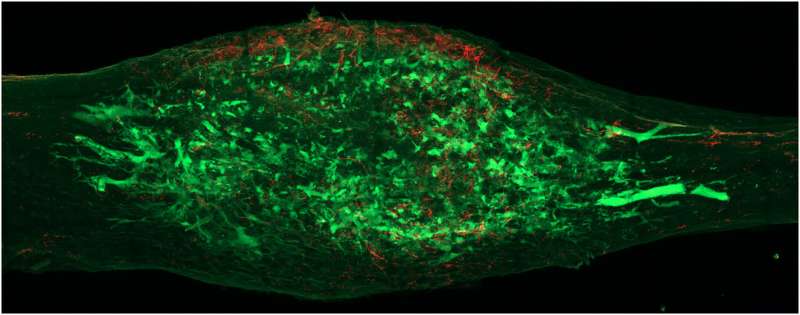 First map of nerve circuitry in bone helps physicians identify key signals for bone repair