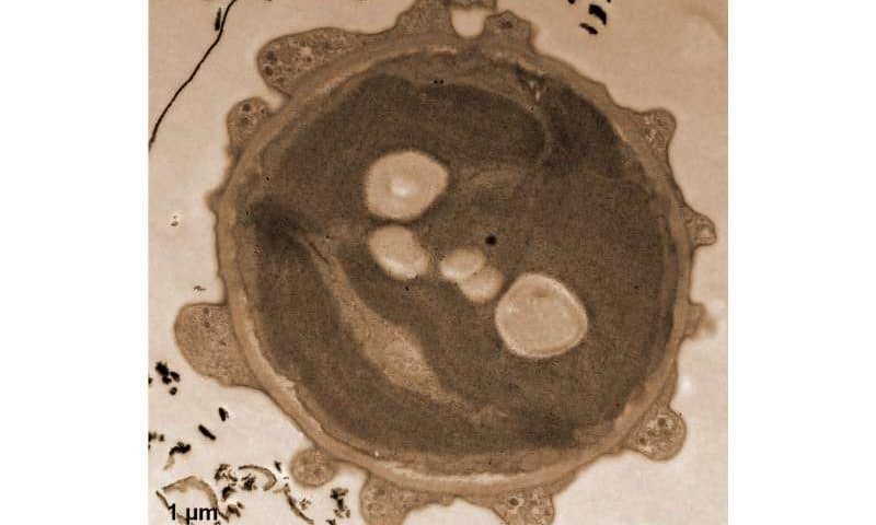Coffee as a staining agent substitute in electron microscopy