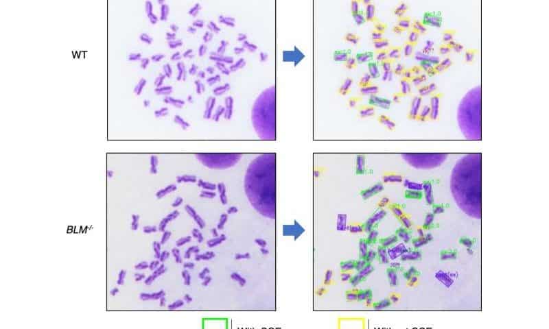Eye for trouble: Automated counting for chromosome issues under the microscope