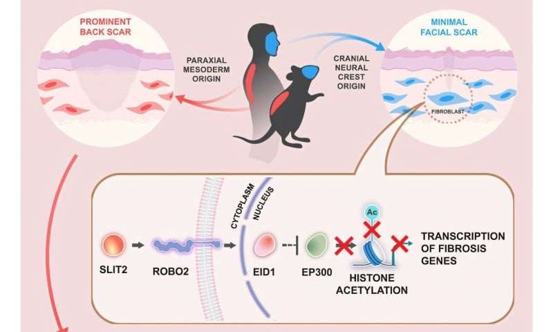 The face scars less than the body: Study explains why