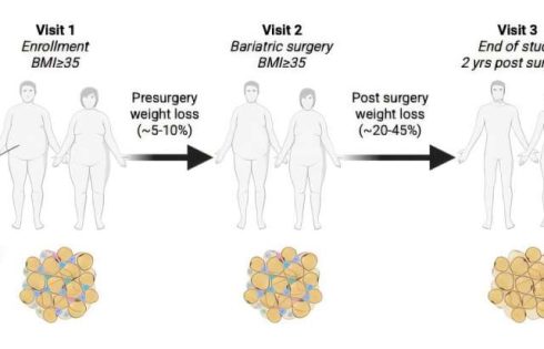 How weight loss benefits the health of your fat tissue