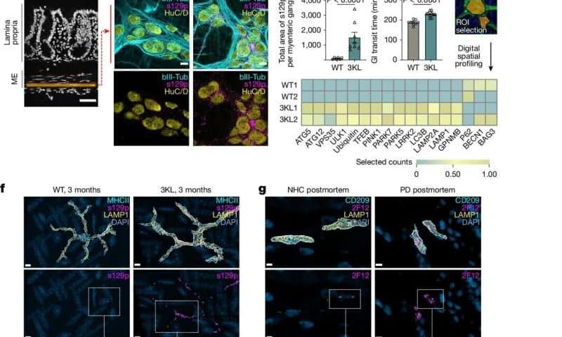 Targeting the gut’s immune system could tackle early stages of Parkinson’s
