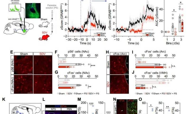 Addiction and appetite along the gut-brain axis: Vagus nerve may play a crucial role in the dopamine reward pathway