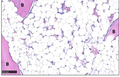 Specific brain signals rapidly eliminate body fat in mice