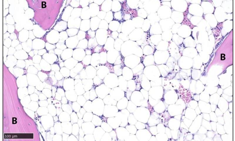 Specific brain signals rapidly eliminate body fat in mice