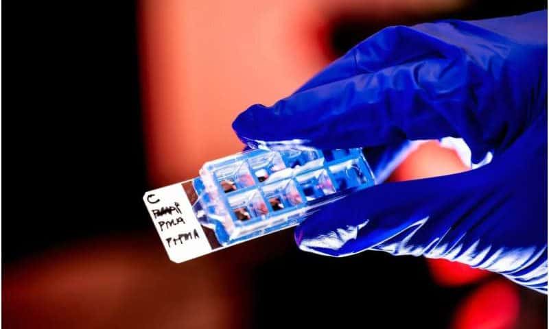 Feeling stressed? These immune cells might be key to understanding why