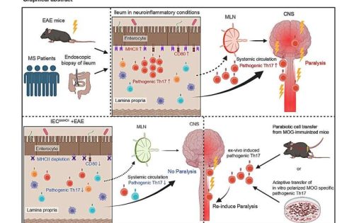 Gut ‘primes’ pathogenic T cells responsible for neuroinflammation in multiple sclerosis, study finds