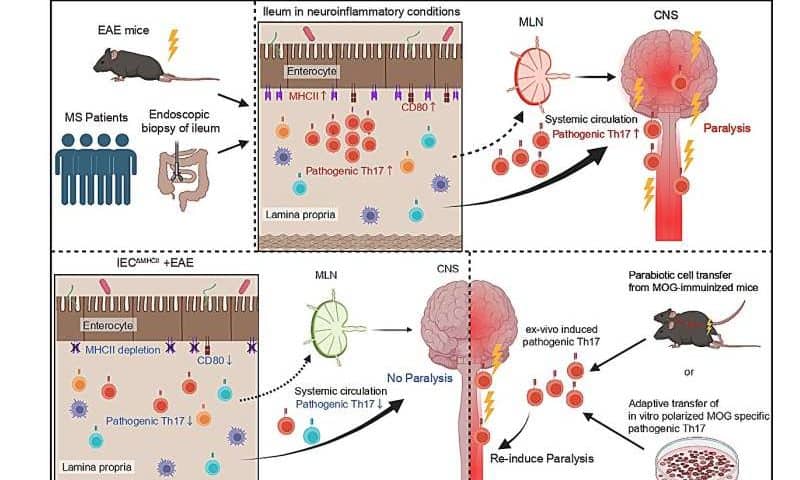 Gut ‘primes’ pathogenic T cells responsible for neuroinflammation in multiple sclerosis, study finds