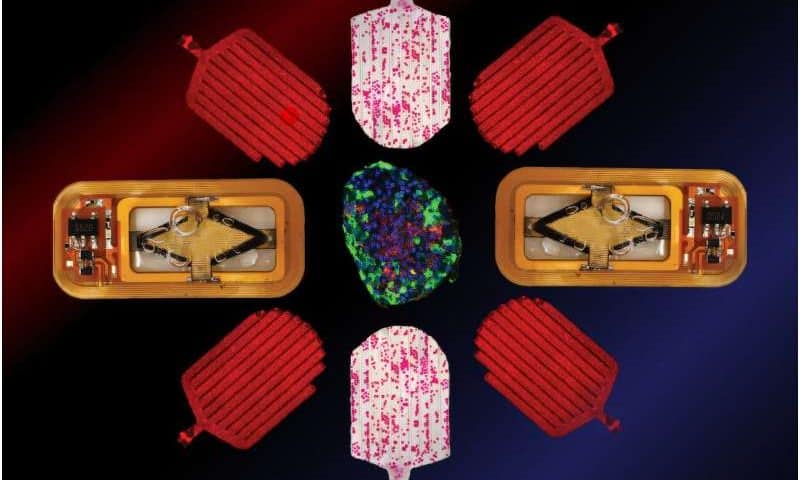 Implantable islet cells could control diabetes without insulin injections