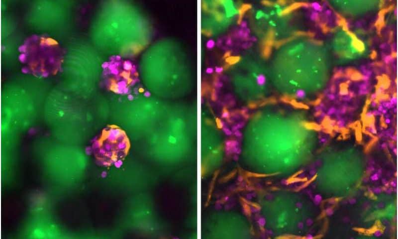 Injectable ‘satellite livers’ could offer an alternative to liver transplantation