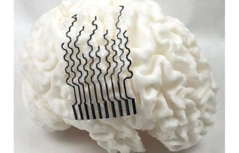 3D-printed brain sensors may unlock personalized neural monitoring