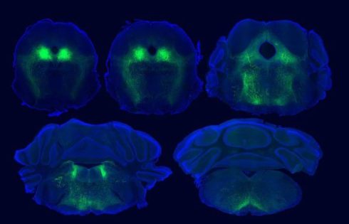 Brain Circuits Underlying Placebo Pain Relief Identified in Mice