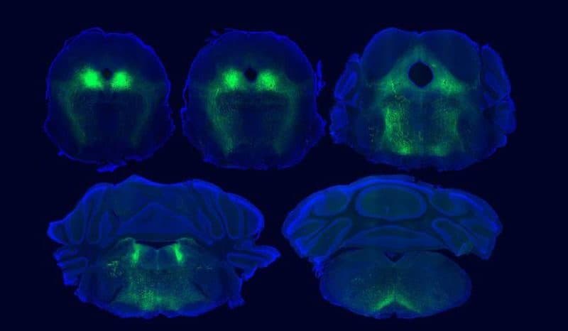 Brain Circuits Underlying Placebo Pain Relief Identified in Mice