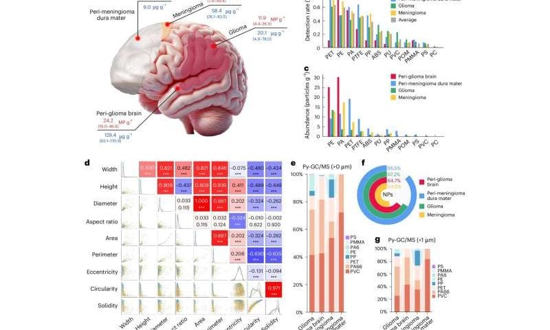 Microplastics turn up in nearly every human brain sample, including healthy tissue