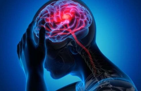 Air pollution associated with increased migraine activity