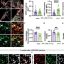 Neuroinflammation triggers autism-like regression in mouse model