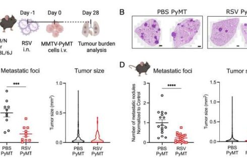 A routine virus can slow breast cancer spread to the lungs, offering hidden protective power