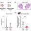 A routine virus can slow breast cancer spread to the lungs, offering hidden protective power