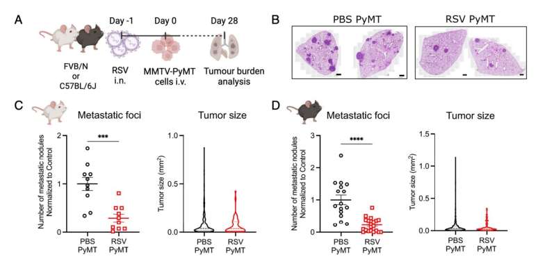 A routine virus can slow breast cancer spread to the lungs, offering hidden protective power