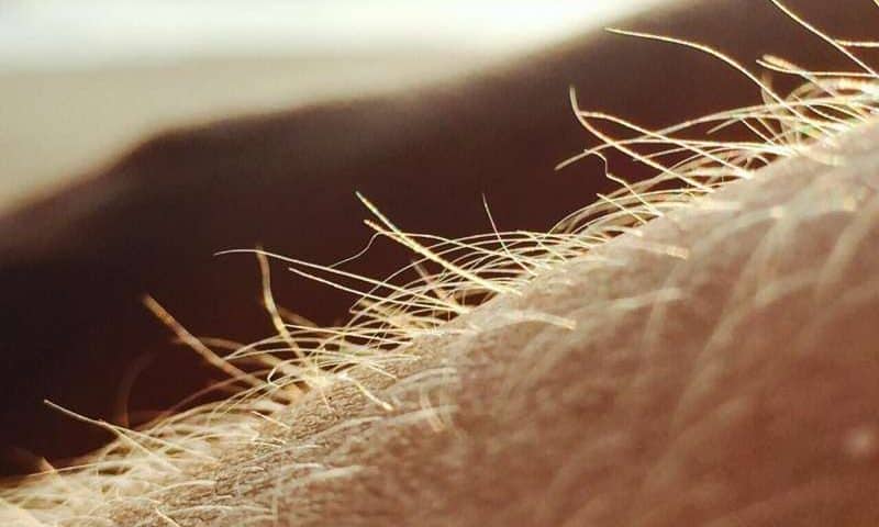 Hidden in hair follicles, immune ‘sentinel’ cells may help skin detect microbes