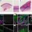 Skin protein K16 found to control inflammation in stressed skin