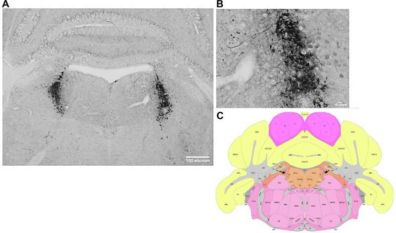 Small dose of antibiotic yields good results in treating panic attacks