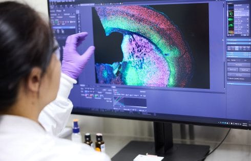 Gene Editing at Scale: Clinic Seeks Generalizable Therapies