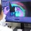 Gene Editing at Scale: Clinic Seeks Generalizable Therapies