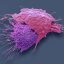 Targeting Metabolic Mechanism Restores Chemotherapy Sensitivity in Ovarian Cancer