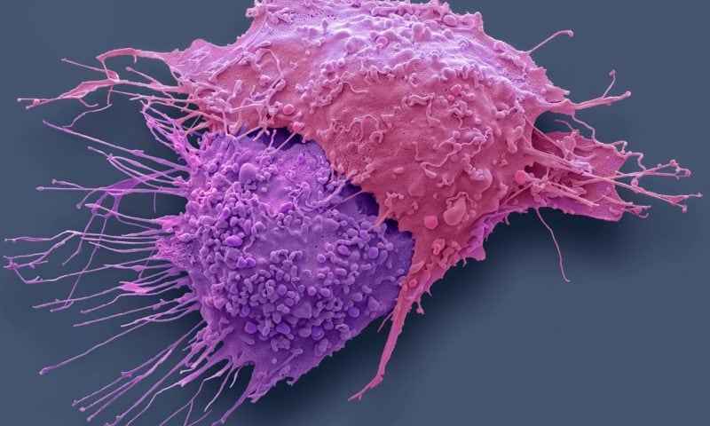 Targeting Metabolic Mechanism Restores Chemotherapy Sensitivity in Ovarian Cancer