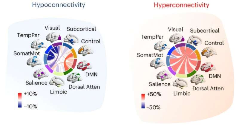 Autism may have two distinct subtypes based on brain connectivity patterns