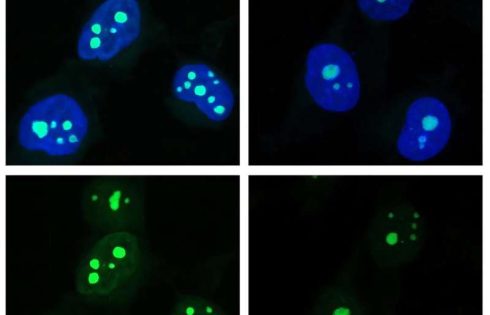 Basil and fennel compound may build up dangerous DNA damage in vulnerable people