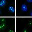 Basil and fennel compound may build up dangerous DNA damage in vulnerable people