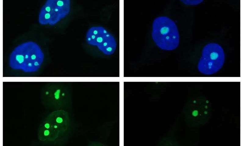 Basil and fennel compound may build up dangerous DNA damage in vulnerable people