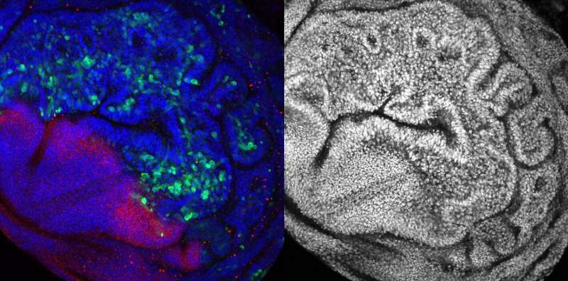 Some tumors eliminate healthy neighboring cells to grow, study reveals