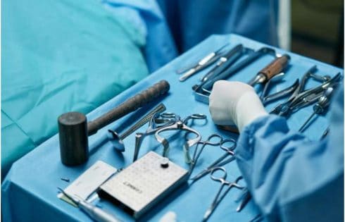 Major surgery may accelerate memory loss in 1 in 7 older adults